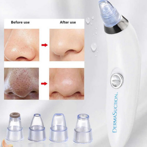 Aparat za čišćenje pora i mitisera - Slika 2