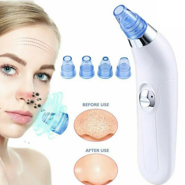 Aparat za čišćenje pora i mitisera - Slika 3