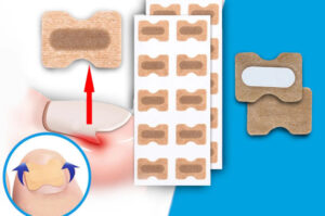 Flasteri za urasle nokte