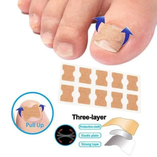 Flasteri za urasle nokte - Slika 3