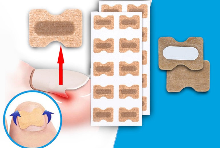 Flasteri za urasle nokte - Slika 5