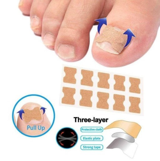 Flasteri za urasle nokte - Slika 6