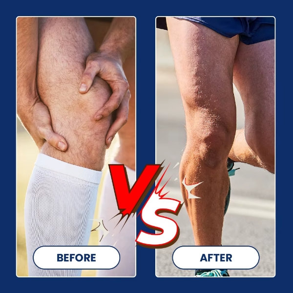 Melem za lecenje meniskusa - Slika 5