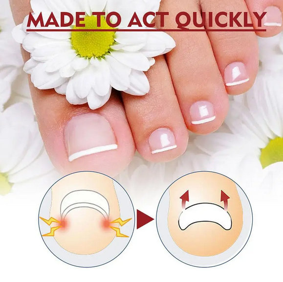 Ulje za urasle nokte - Slika 16