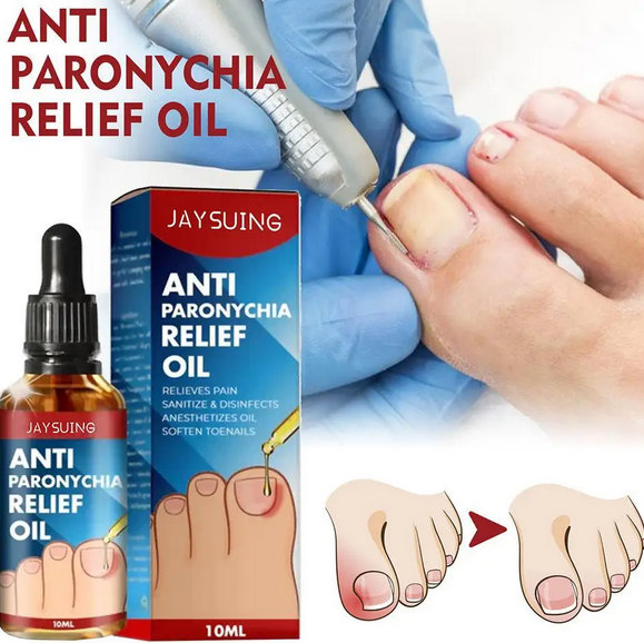 Ulje za urasle nokte - Slika 19