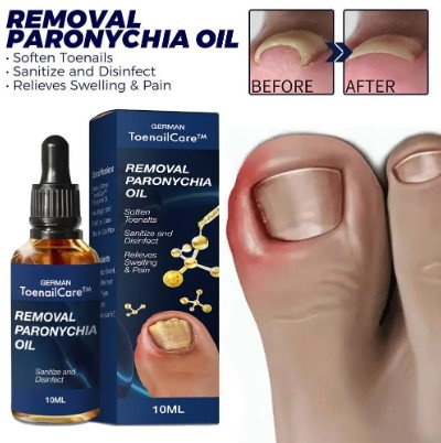 Ulje za urasle nokte - Slika 5