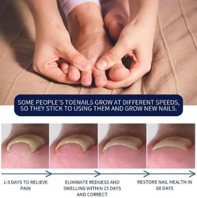 Ulje za urasle nokte - Slika 8