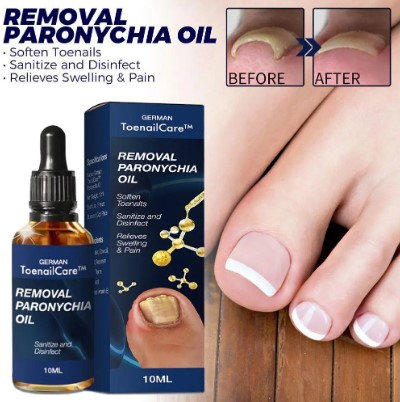 Ulje za urasle nokte - Slika 9