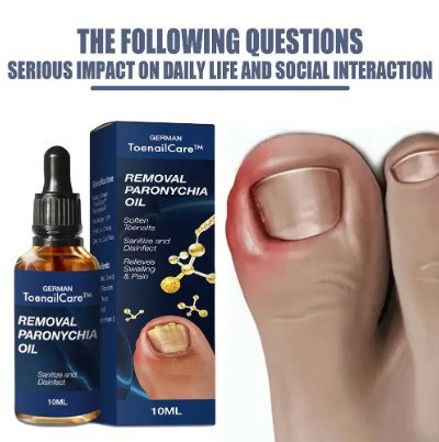 Ulje za urasle nokte - Slika 10