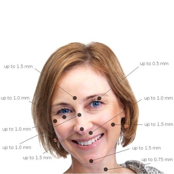 Derma roler - Slika 5