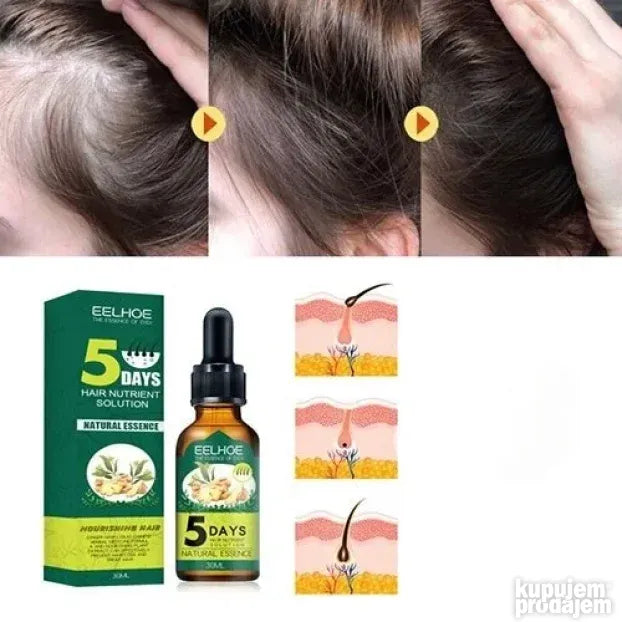 Eelhoe Serum protiv opadanja i brzi rast kose - Slika 6