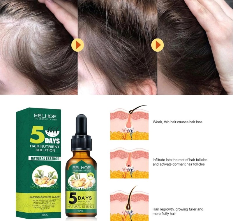 Eelhoe Serum za Brzi Rast Kose na Bazi Dumbira - Slika 3