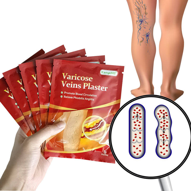 Flasteri za varikozne prosirene vene 6 KOMADA