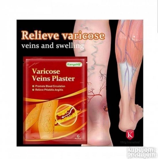 Flasteri za vene Flasteri za prosirene vene 6 komada