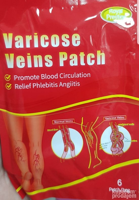 Flasteri za vene Flasteri za prosirene vene 6 komada