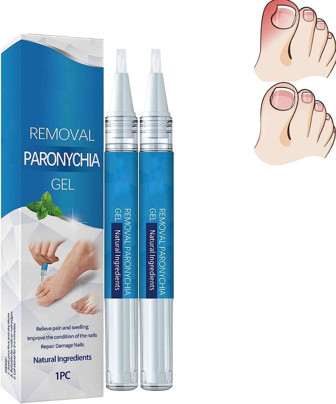 Nega noktiju na nogama gel za popravku ostećenja noktiju