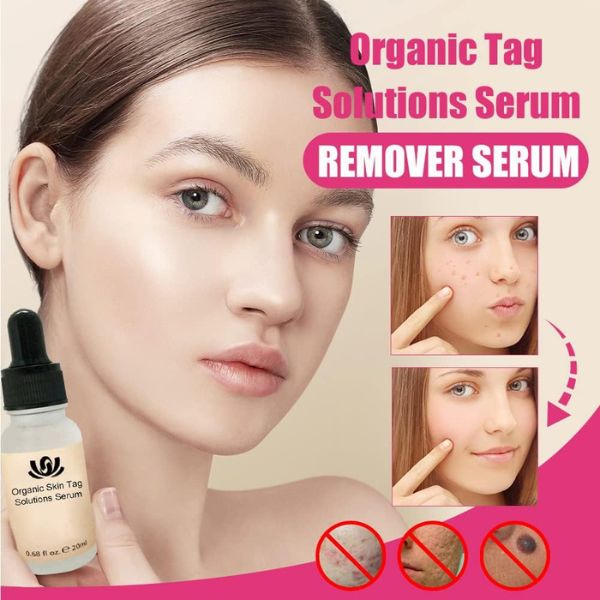 Organic Solutions Serum za uklanjanje nesavrsenosti na kozi