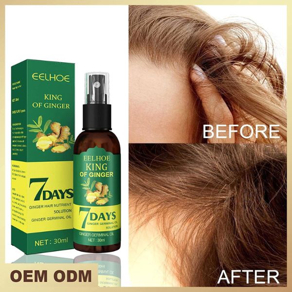 Sedmodnevni tretman za brzi rast kose od dumbira Ginger Hair Growth Sprayer