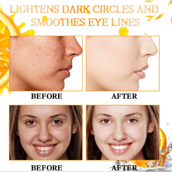 Serum za lice sa Vitaminom C Eelhoe - Slika 4