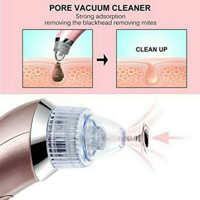 Vakum aparat za ciscenje pora i mitisera