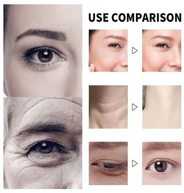 Vitamin C Serum za Lice Korektor Tamnih Mrlja i Bora